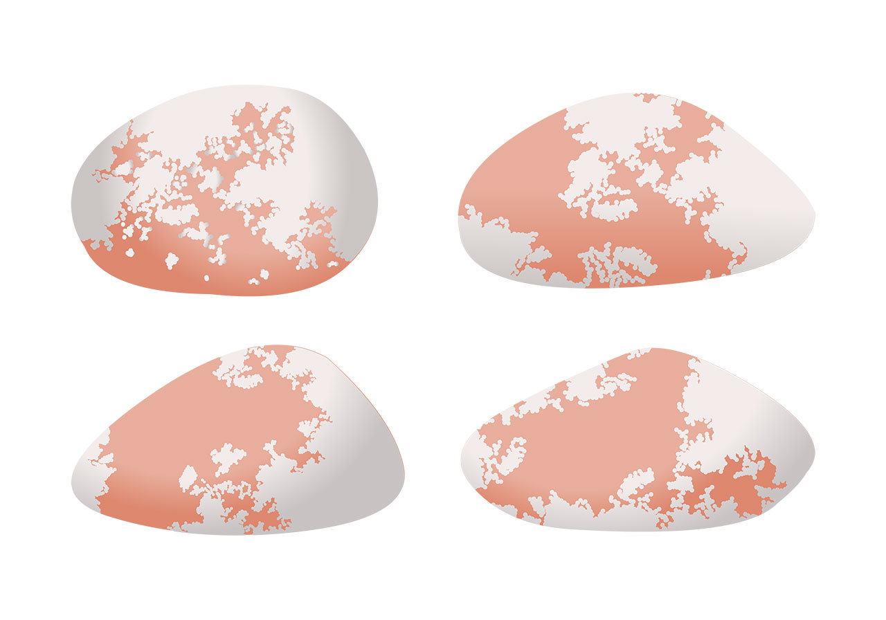 Pebbles, rocks, stones vector graphic. Beautiful river bed rocks vector graphic. Four smooth, abstract forms, resembling stylized pebbles or polished stones, vector graphic. Vector graphic with CC0 license, best for a variety of projects, including designs, animations, and more.